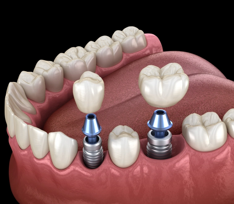 Understanding Oral Cancer
