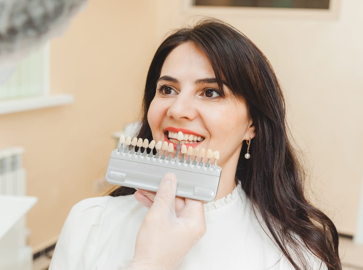 Veneers in Charlotte